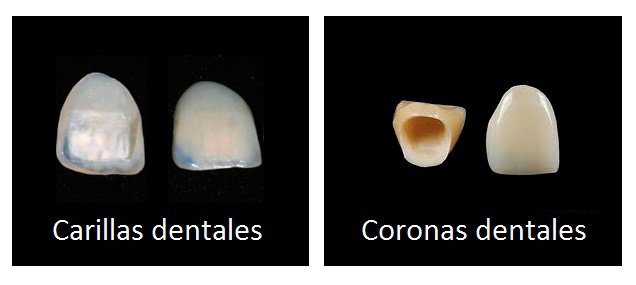 DENTISTA PUERTO SANTA MARÍA